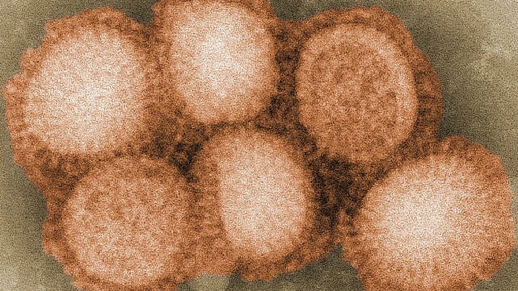 H3N8 – o nouă gripă ameninţă lumea