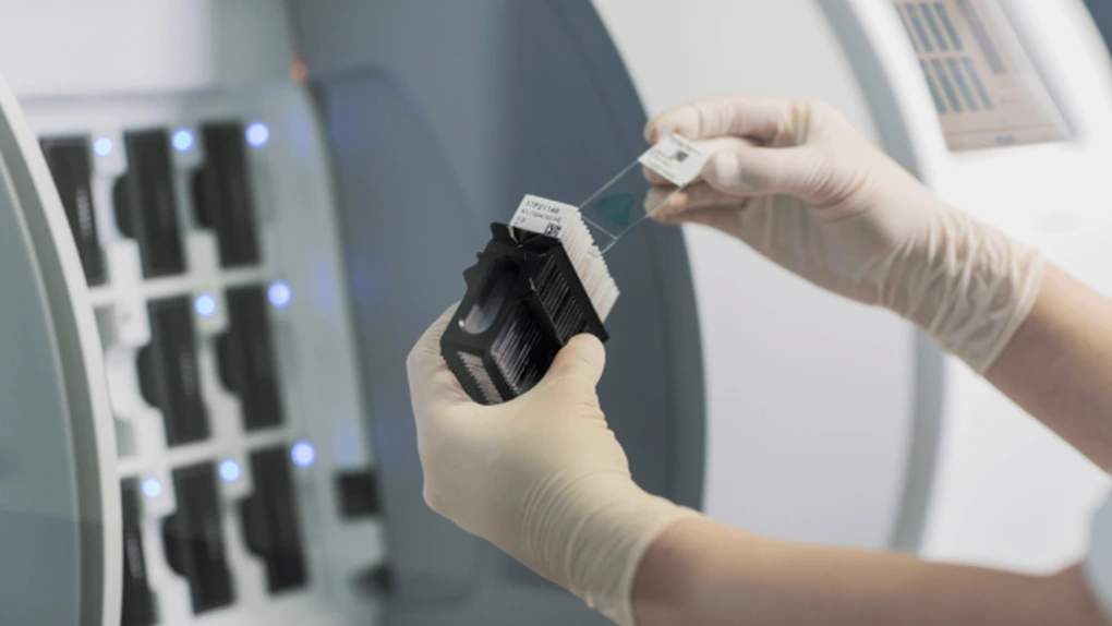 Compania Synevo România recoltează probe pentru teste Real Time PCR în 50 de centre, amplasate în 36 de orașe