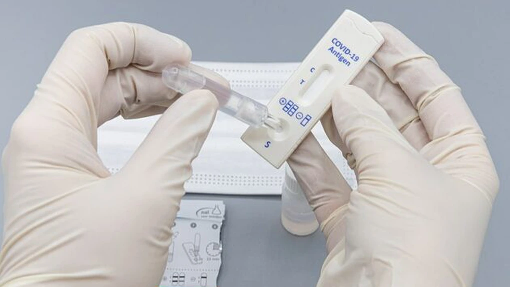 Preţul mediu al unui test RT-PCR este de 322 de lei - Consiliul Concurenței