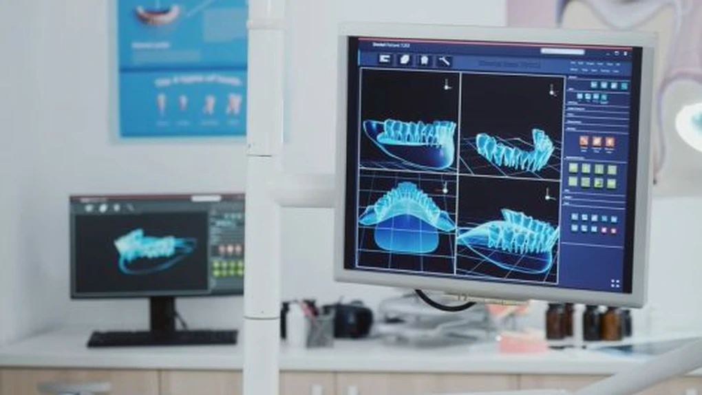 Încă o țară în care o companie românească devine lider. Dental Holding a cumpărat grupul grecesc Memodent