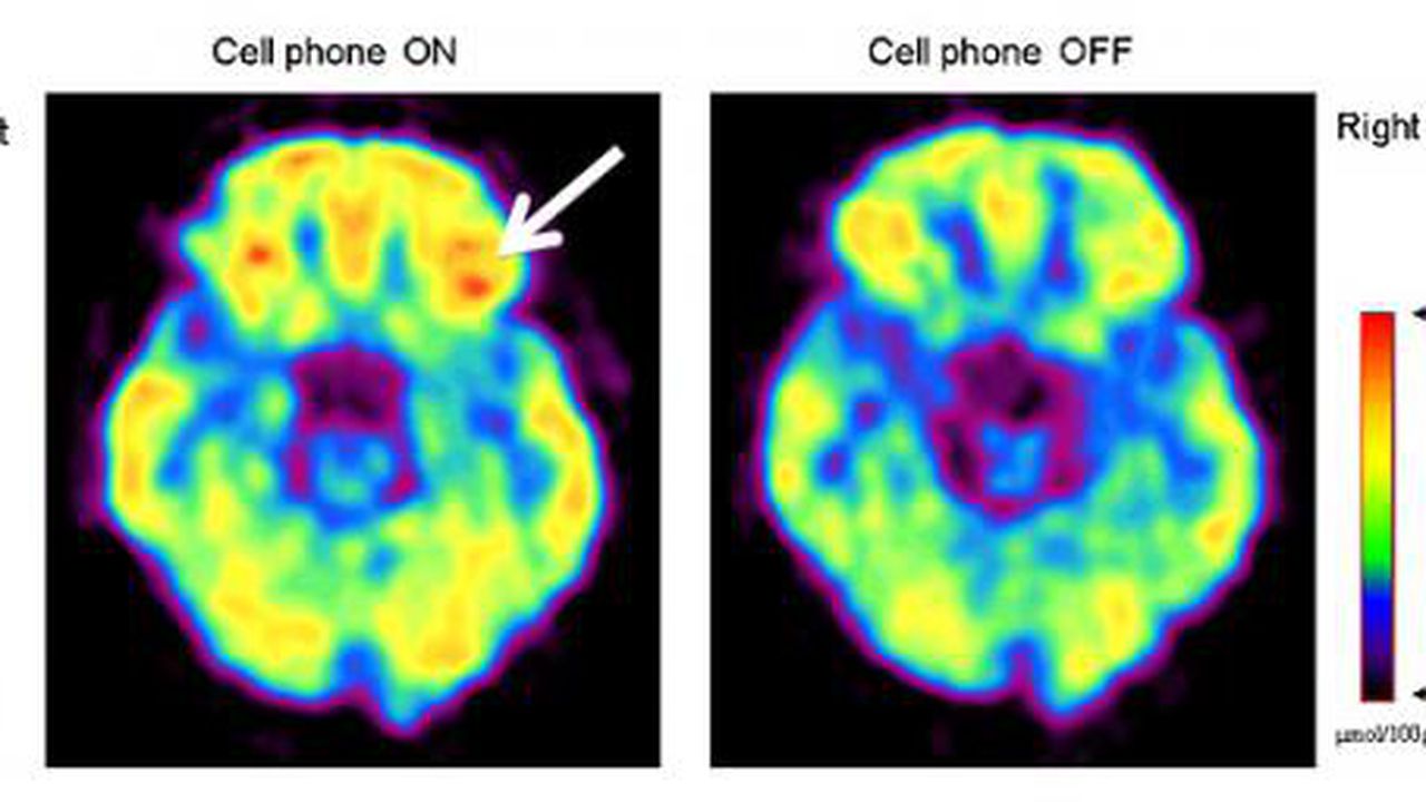 cellphonescans_600px_1306394808_500_255_75_94035500