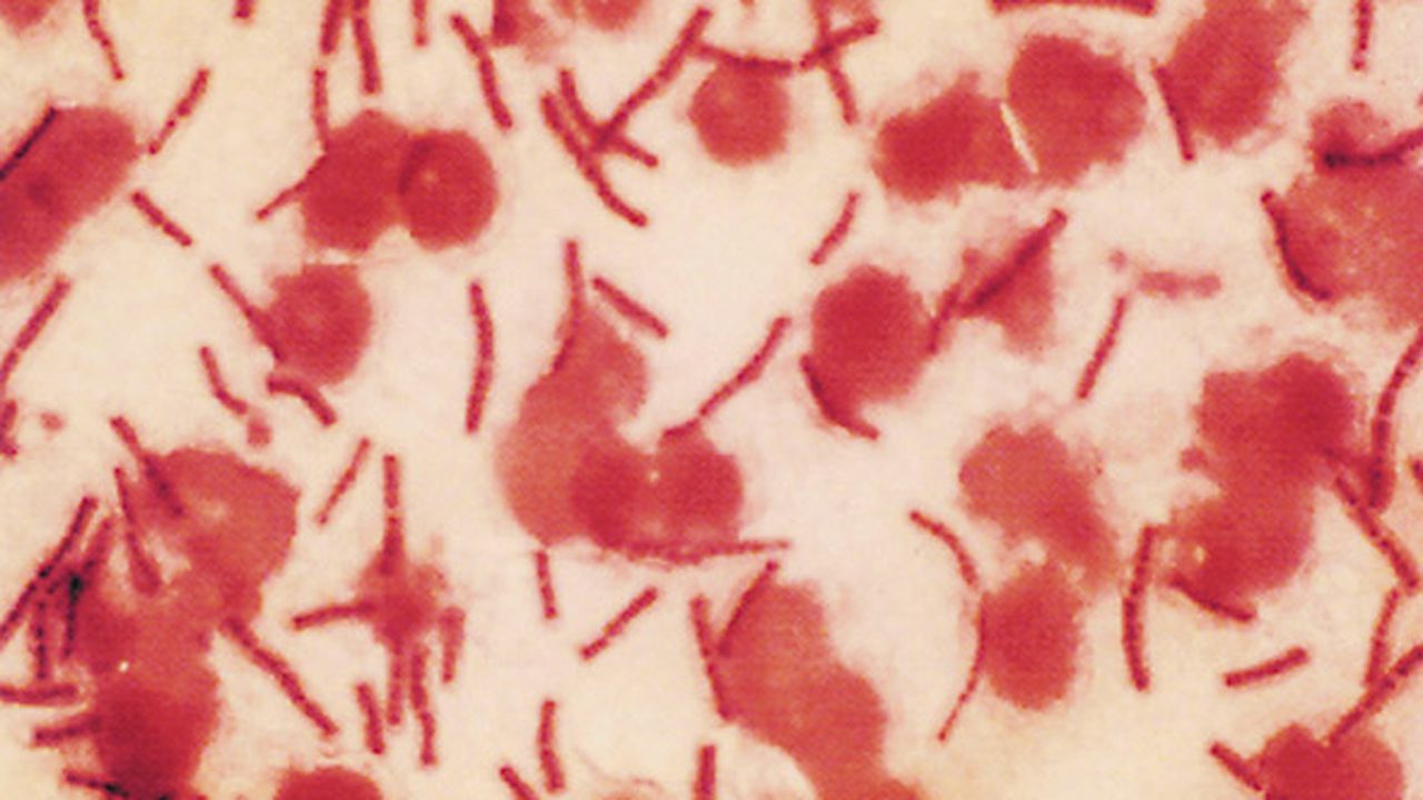 anthrax_4567898765_26622600