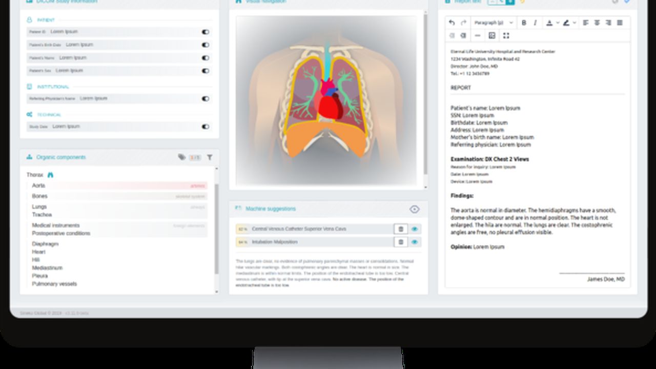 sineko_graid_monitor_77302700