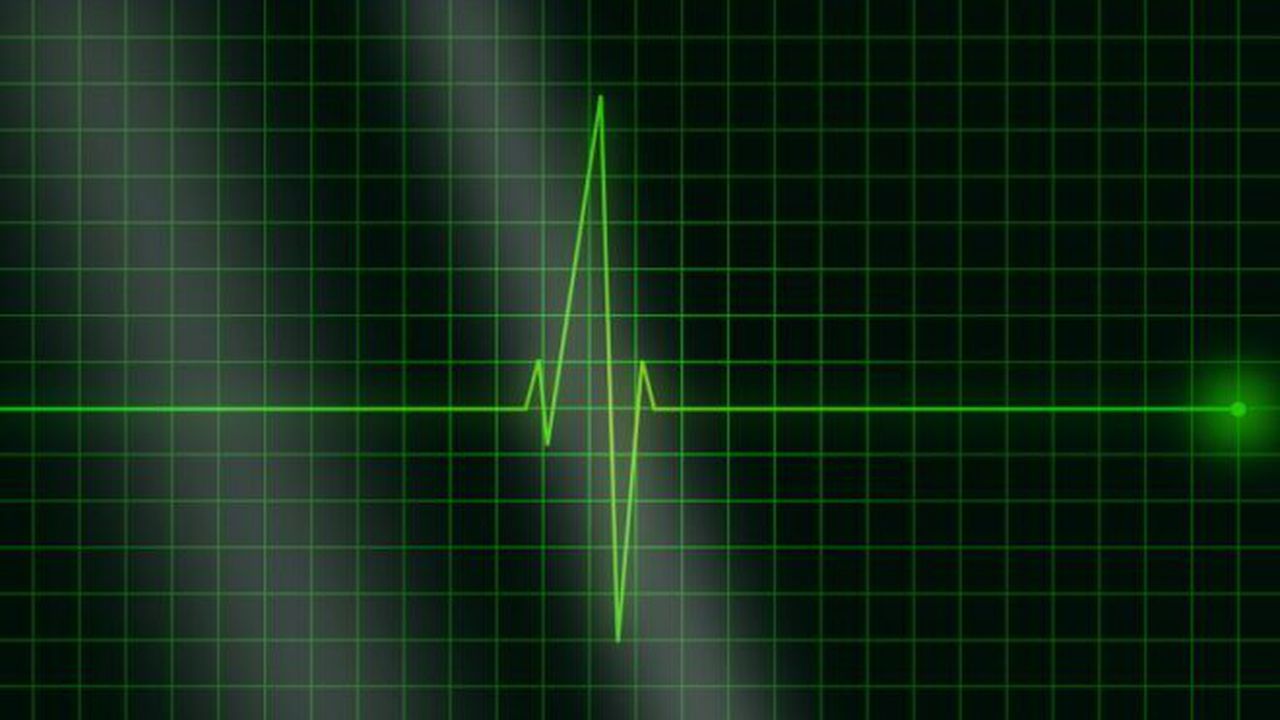 electrocardiograma 6754834754893