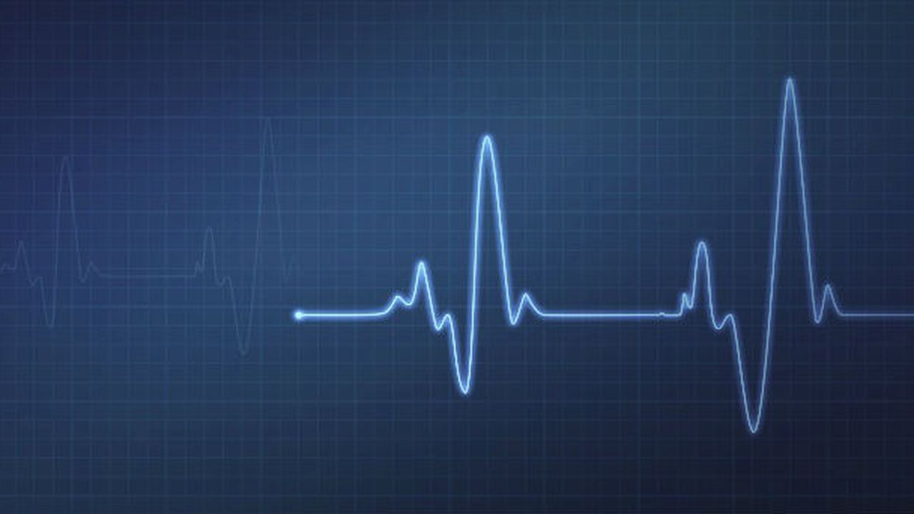 electrocardiograma 45678987654