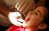 Oamenii cheltuie, în medie, 2.000 de lei pe an pentru tratamente dentare, iar jumătate dintre români nu merg deloc la dentist – sondaj Kantar; Ionuţ Leahu: Statul a abandonat pacientul de stomatologie