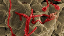 Caz suspect de Ebola în Cehia. Autoritățile au lansat un răspuns de urgență pe scară largă