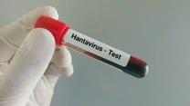 Oficial. Hantavirus în România. Pacientul infectat, internat la psihiatrie de trei ani,  nu are legătură cu focarul de pe nava de croazieră