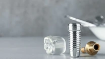 Avantajele Straumann fata de alte branduri premium de implanturi