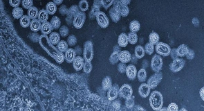 Gripă aviară la „Peneș Curcanul”. ANSVSA spune că nu există posibilitatea afectării sănătății populației