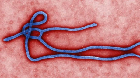 Ebola: O companie canadiană anunţă un rezultat promiţător al unui vaccin împotriva maladiei