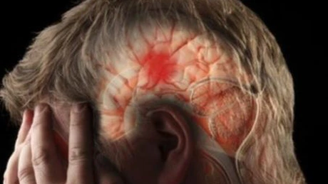 România, pe locul trei în Europa la incidenţa bolilor cerebrovasculare