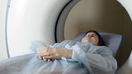 Neurologi: Riscul unui accident vasculat cerebral la tineri este tot mai mare
