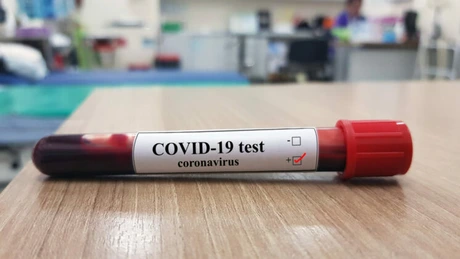 Autoritățile americane au autorizat un nou test pentru detectarea Covid-19, care poate să fie făcut la domiciliu folosind o proba de salivă