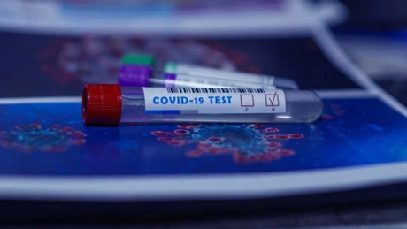 GCS: Încă 1.552 de persoane au fost confirmate în ultimele 24 de ore ca fiind infectate cu noul coronavirus, iar 54 au decedat din cauza bolii