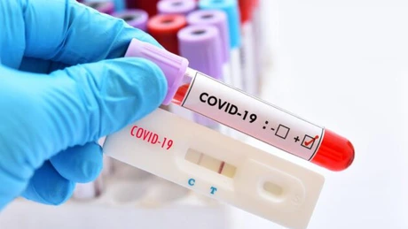 Tătaru: A avut loc o primă întâlnire a experţilor pentru identificarea soluţiilor de utilizare a testelor rapide antigen Coronavirus