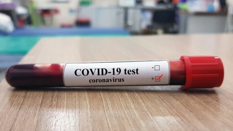 INSP: 51,4% dintre cazurile de COVID-19 au fost la persoane nevaccinate, în săptămâna 31 ianuarie - 6 februarie