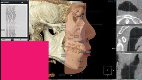 Reţeaua de imagistică dentară DigiRay estimează că va închide 2024 cu afaceri nete de peste 37 de milioane de lei, cu 53% mai mari decât cele din 2022