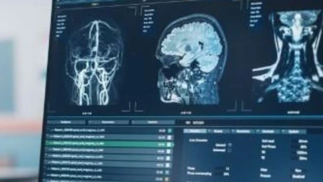 Spitalul privat Memorial al turcilor de la MSG Uluslararasi Saglik Yatirimlari a realizat afaceri nete de peste 146 de milioane de lei în 2024, cu 25% mai mari decât în 2023, şi continuă în pierdere