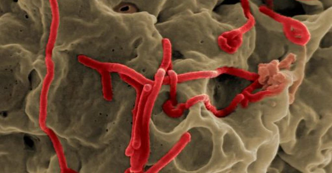 Caz suspect de Ebola în Cehia. Autoritățile au lansat un răspuns de urgență pe scară largă