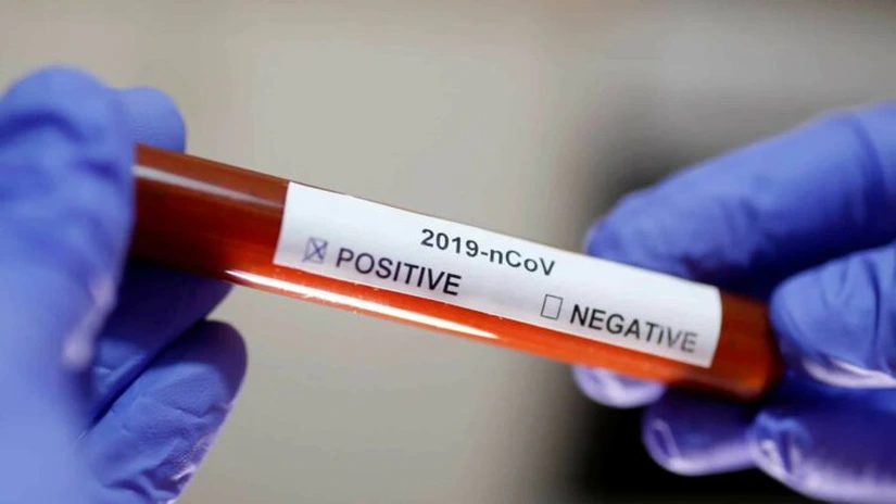 GCS: Încă 1.311 cazuri de infectare cu noul coronavirus au fost confirmate în România, iar 27 de persoane au decedat din cauza bolii