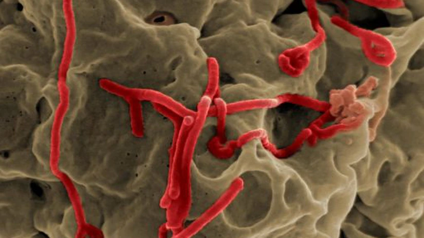 Caz suspect de Ebola în Cehia. Autoritățile au lansat un răspuns de urgență pe scară largă